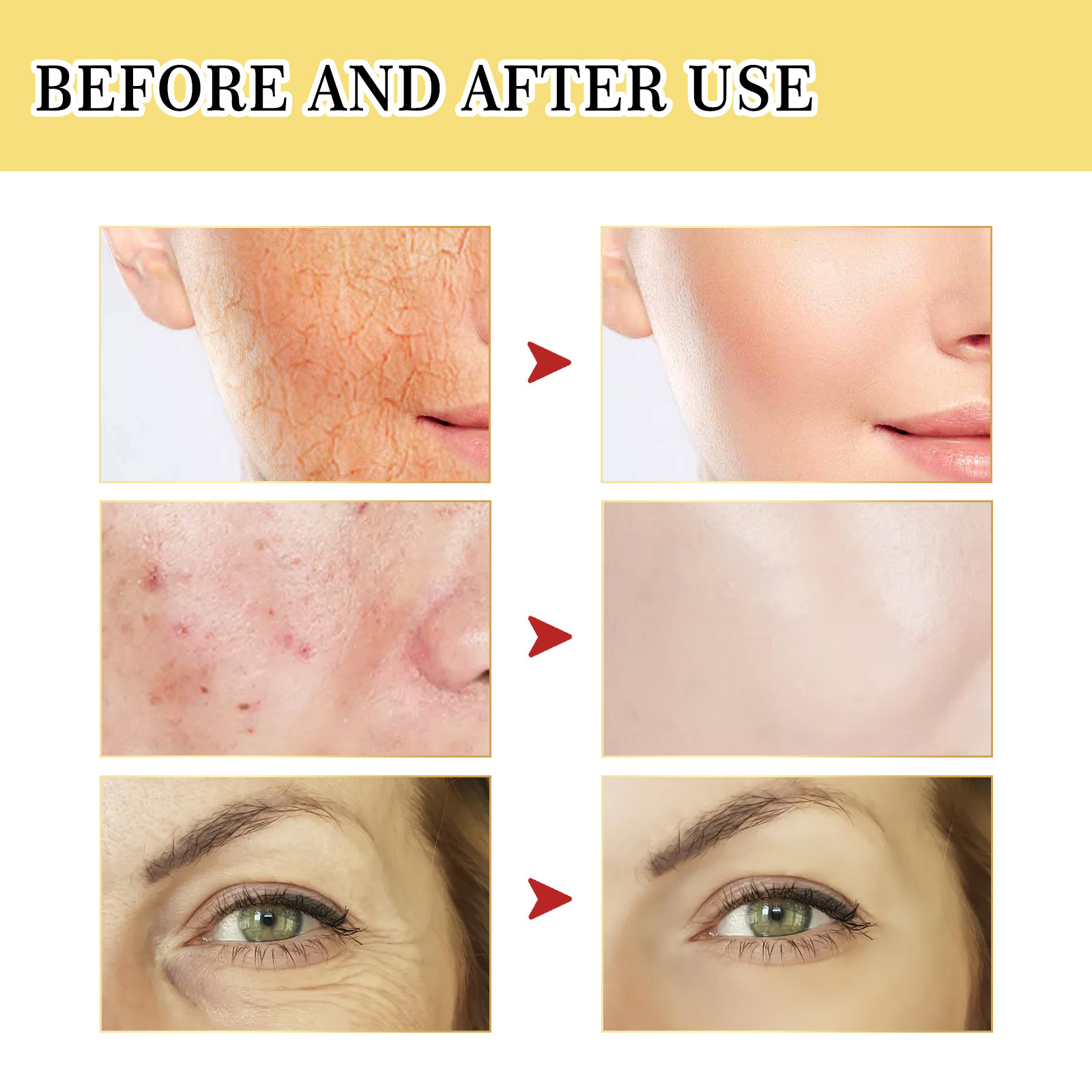 Essência reparadora do mucina  - Snail Mucin 96 Repair Essence avaliação e preço