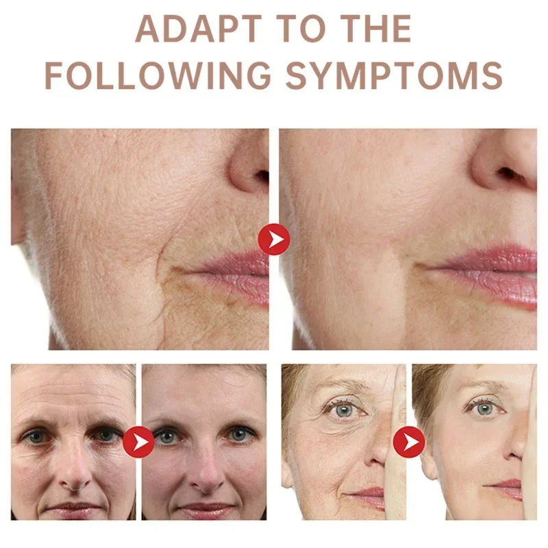 Remover rugas creme retinol ro - Retinol Anti Wrinkle Cream avaliação e preço