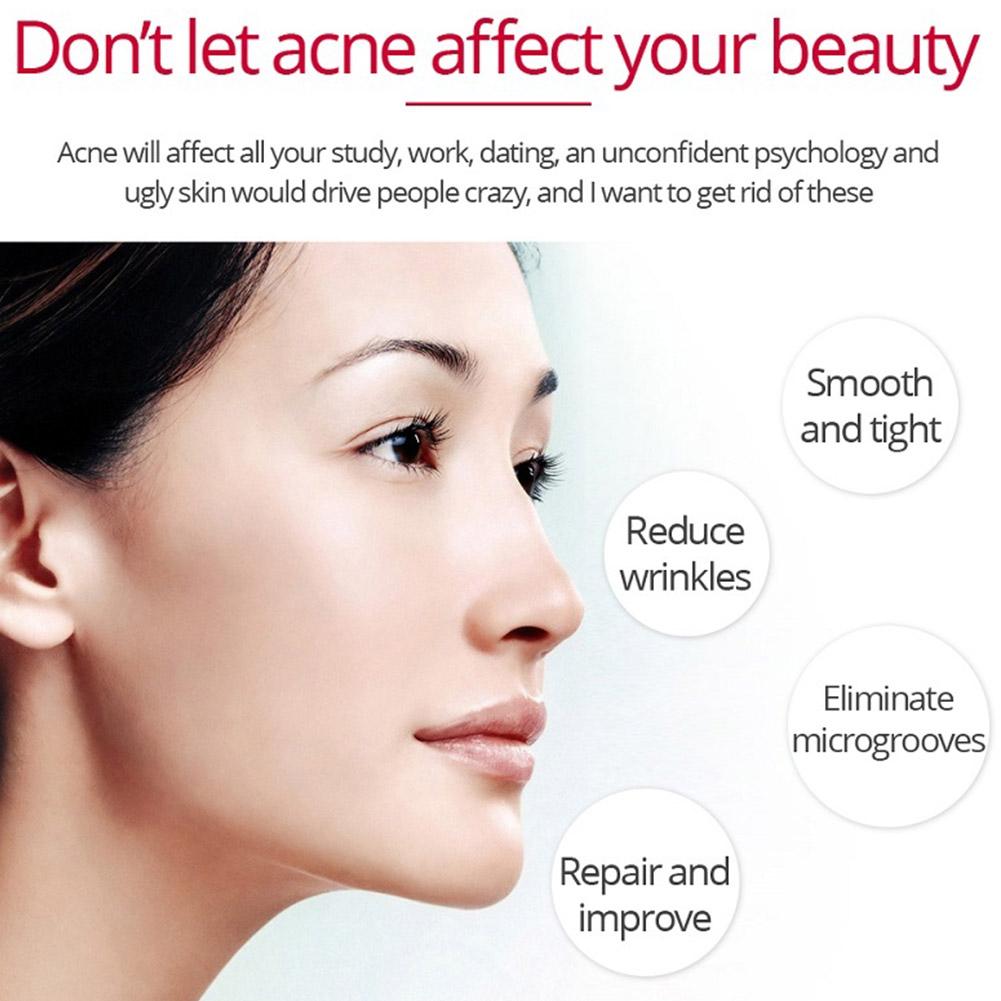Retinol Lifting Creme Firming, - Retinol Anti Wrinkle Cream avaliação e preço