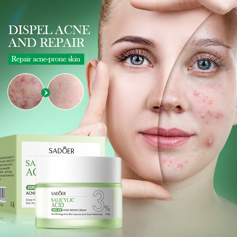 Creme de Tratamento para Acne  - Salicylic Acid Blackhead Remover avaliação e preço